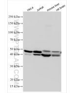 EIF3F Polyclonal antibody 31630-1-AP proteintech