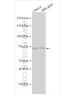 KBTBD11 Polyclonal antibody 31778-1-AP proteintech