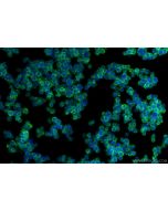 CD2 Polyclonal antibody 31803-1-AP proteintech