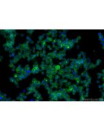 NTB-A/SLAMF6 Polyclonal antibody 31807-1-AP proteintech