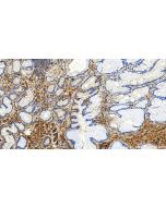 Serum amyloid P component Polyclonal antibody 31813-1-AP proteintech