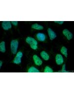 CHD7 Polyclonal antibody 31919-1-AP proteintech
