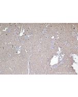 DOCK11 Polyclonal antibody 31993-1-AP proteintech