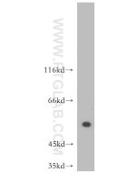 ATF4 Polyclonal antibody Proteintech  10835-1-AP