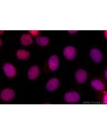 BCL9L Polyclonal antibody 32103-1-AP proteintech