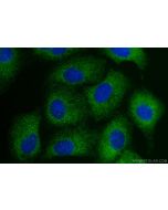 SAV1 Polyclonal antibody 32277-1-AP proteintech