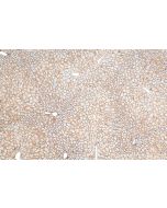 ALCAM Polyclonal antibody 32402-1-AP proteintech
