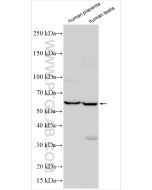 KCTD7 Polyclonal antibody 32488-1-AP proteintech