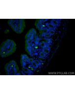 MAdCAM1 Polyclonal antibody 32526-1-AP proteintech