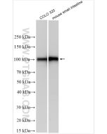 MEP1B Polyclonal antibody 32828-1-AP proteintech