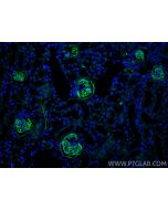 Podoplanin Polyclonal antibody 33099-1-AP proteintech