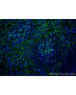 CD8a Polyclonal antibody 33186-1-AP proteintech