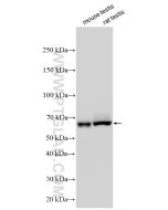 TSKS Polyclonal antibody 33992-1-AP proteintech