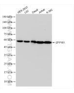 ZFP161 / ZBTB14 Recombinant monoclonal antibody Proteintech  83909-4-RR