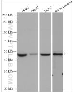 Cyclin E1 Polyclonal antibody Proteintech  11554-1-AP