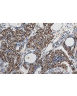 POTEA-Specific Recombinant monoclonal antibody Proteintech  84298-1-RR