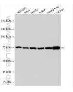Methylmalonyl Coenzyme A mutase/MUT Recombinant monoclonal antibody Proteintech  84879-5-RR