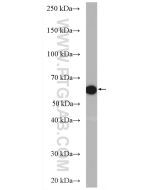 PADI4/PAD4 Polyclonal antibody Proteintech  17373-1-AP