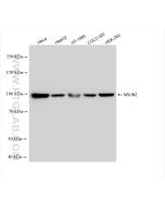 NSUN2 Recombinant monoclonal antibody Proteintech  82894-7-RR