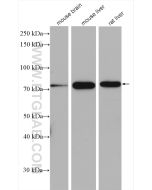 ERp72 Polyclonal antibody Proteintech  14712-1-AP