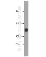 CYP1A2-Specific Polyclonal antibody Proteintech  19936-1-AP