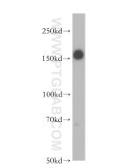 IRS1 Polyclonal antibody Proteintech  17509-1-AP