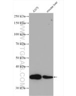 Fibrillarin Polyclonal antibody Proteintech  16021-1-AP