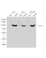 ATP1A1 Recombinant monoclonal antibody Proteintech  83191-6-RR