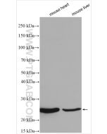 ATP5F1 Polyclonal antibody Proteintech  15999-1-AP