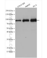 DDX21 Polyclonal antibody Proteintech  10528-1-AP