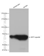 Cytokeratin 1-specific Recombinant monoclonal antibody Proteintech  82972-1-RR