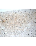 HuC Polyclonal antibody 55047-1-AP proteintech