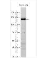 Integrin alpha-8 Polyclonal antibody 55068-1-AP proteintech