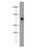 PKMYT1 Polyclonal antibody 55098-1-AP proteintech