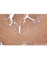 ATP13A3 Polyclonal antibody 55108-1-AP proteintech