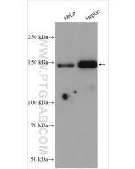 NAIP Polyclonal antibody 55153-1-AP proteintech
