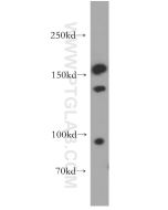 CD11d/Integrin Alpha D Polyclonal antibody 55162-1-AP proteintech