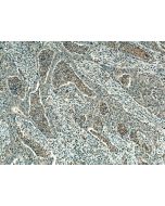 PCSK9 Polyclonal antibody 55206-1-AP proteintech