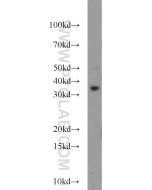 FOXE3 Polyclonal antibody 55301-1-AP proteintech
