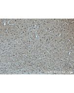 SNIP/p140Cap Polyclonal antibody 55362-1-AP proteintech