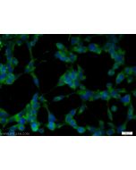 EXOC6B Polyclonal antibody 55440-1-AP proteintech