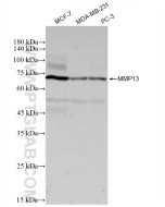 MMP13 Recombinant monoclonal antibody Proteintech  83188-4-RR
