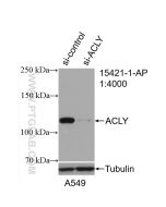 ACLY Polyclonal antibody Proteintech  15421-1-AP