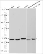 CYP17A1 Polyclonal antibody Proteintech  14447-1-AP