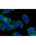 GDI2 Monoclonal antibody, PBS Only 60078-1-PBS proteintech