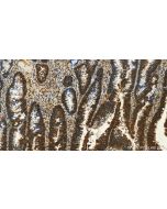 SMN (Human,Mouse,Rat) Monoclonal antibody, PBS Only 60154-2-PBS proteintech