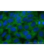 AMACR/p504S Monoclonal antibody 60240-1-Ig proteintech