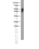 IL-17F Monoclonal antibody 60245-1-Ig proteintech