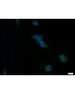 CD39/ENTPD1 Monoclonal antibody, PBS Only 60323-1-PBS proteintech