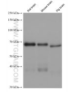 DCP1A Monoclonal antibody, PBS Only 60494-1-PBS proteintech